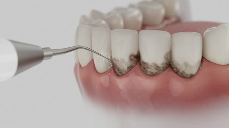 Reliable Dental Implants contractor in Perry, OH by Smile Center Dentistry
